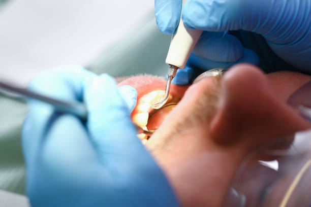 Best Broken or Cracked Tooth Emergency Dentist in Ferriday, LA